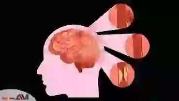 تشخیص علائم و نشانه های تومور مغزی
